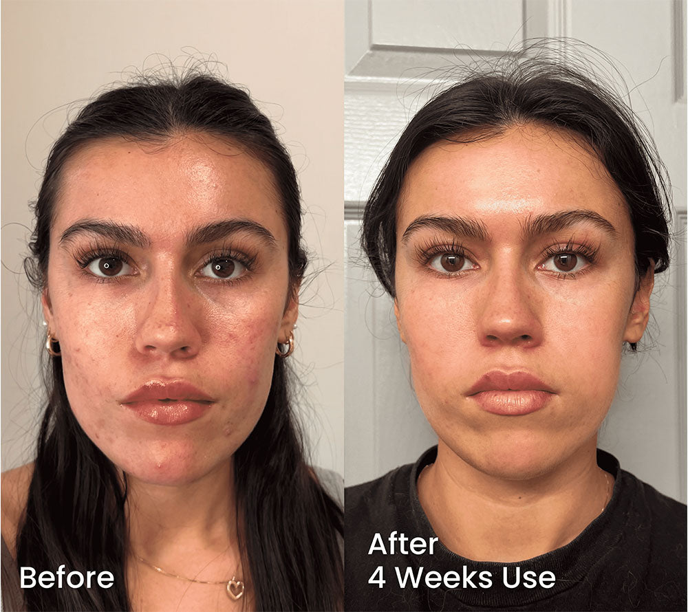 Visible Results | Real Transformations with Zelaze Skincare