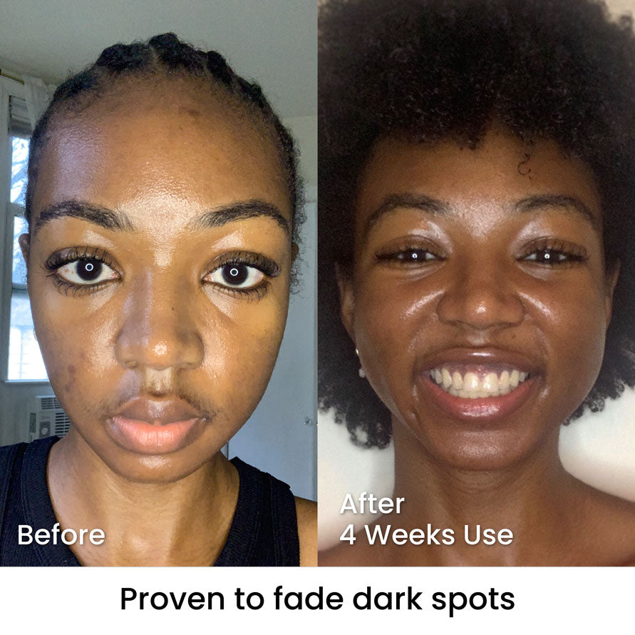 Visible Results | Real Transformations with Zelaze Skincare