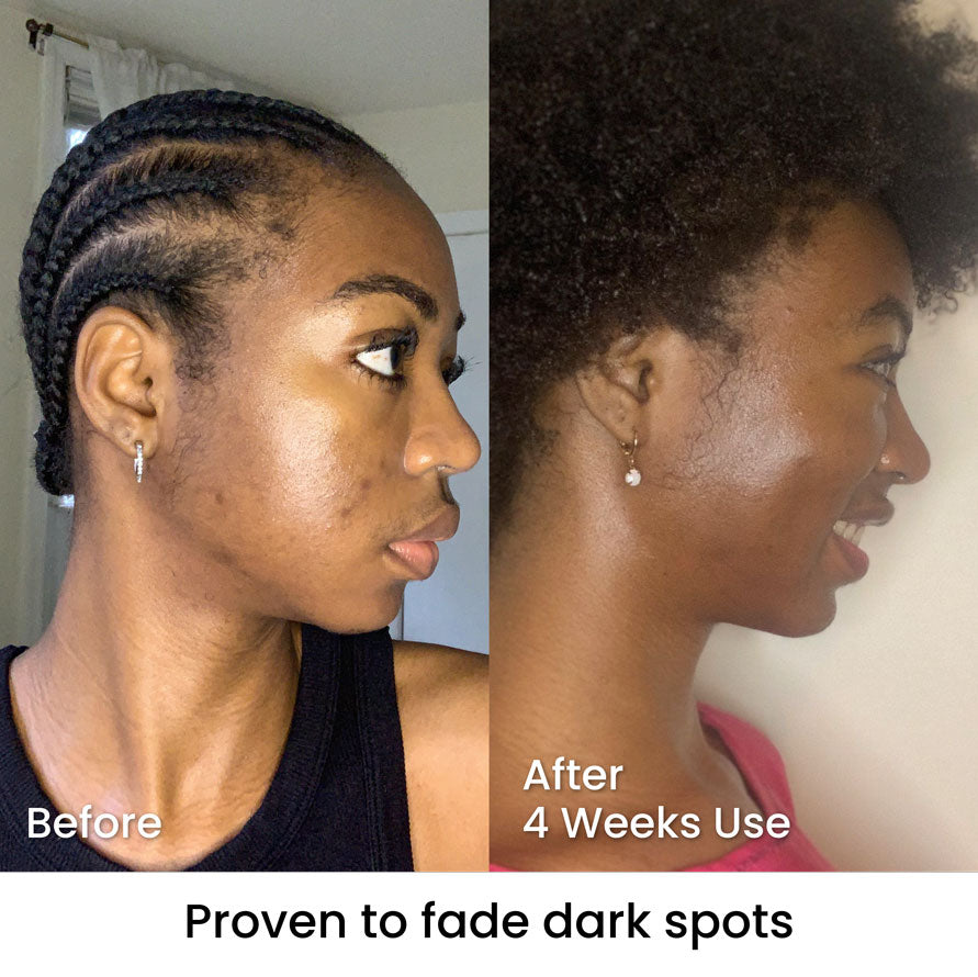 Visible Results | Real Transformations with Zelaze Skincare