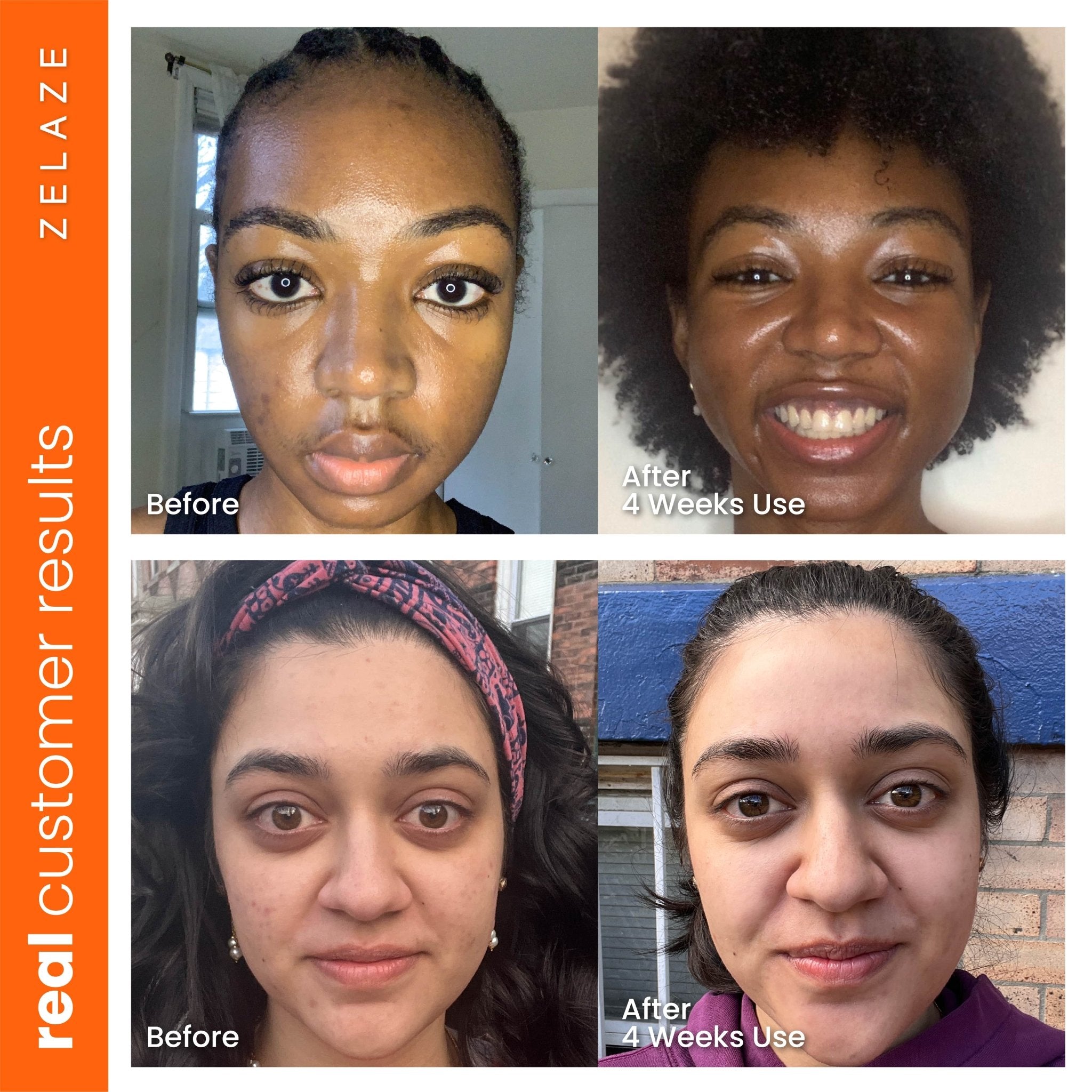 Turmeric Ginseng Brightening Moisturizer | Natural Skincare Turmeric Ginseng Brightening Moisturizer | Natural Skincare
